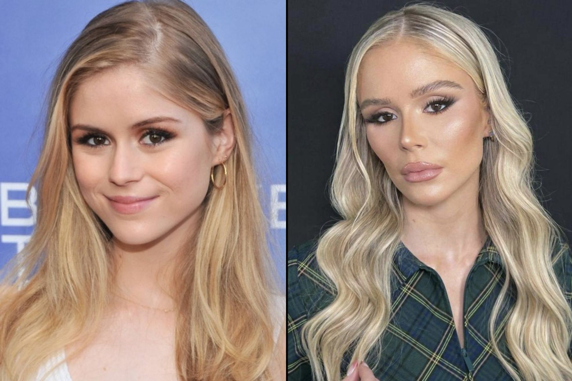 The Boys' actress Erin Moriarty's incredible before and after: Fans accuse  her of plastic surgery