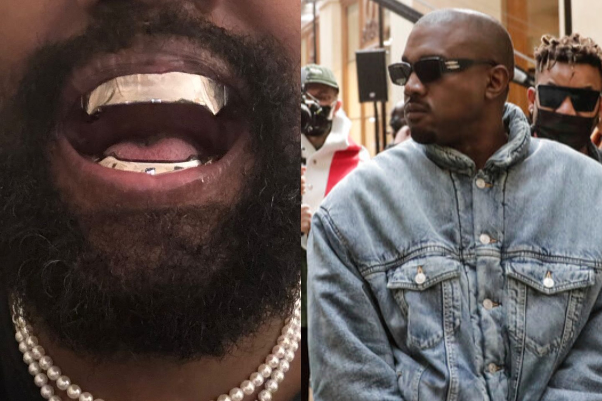 Kanye West spends almost 1 million dollars on titanium grill, did he remove all his teeth?