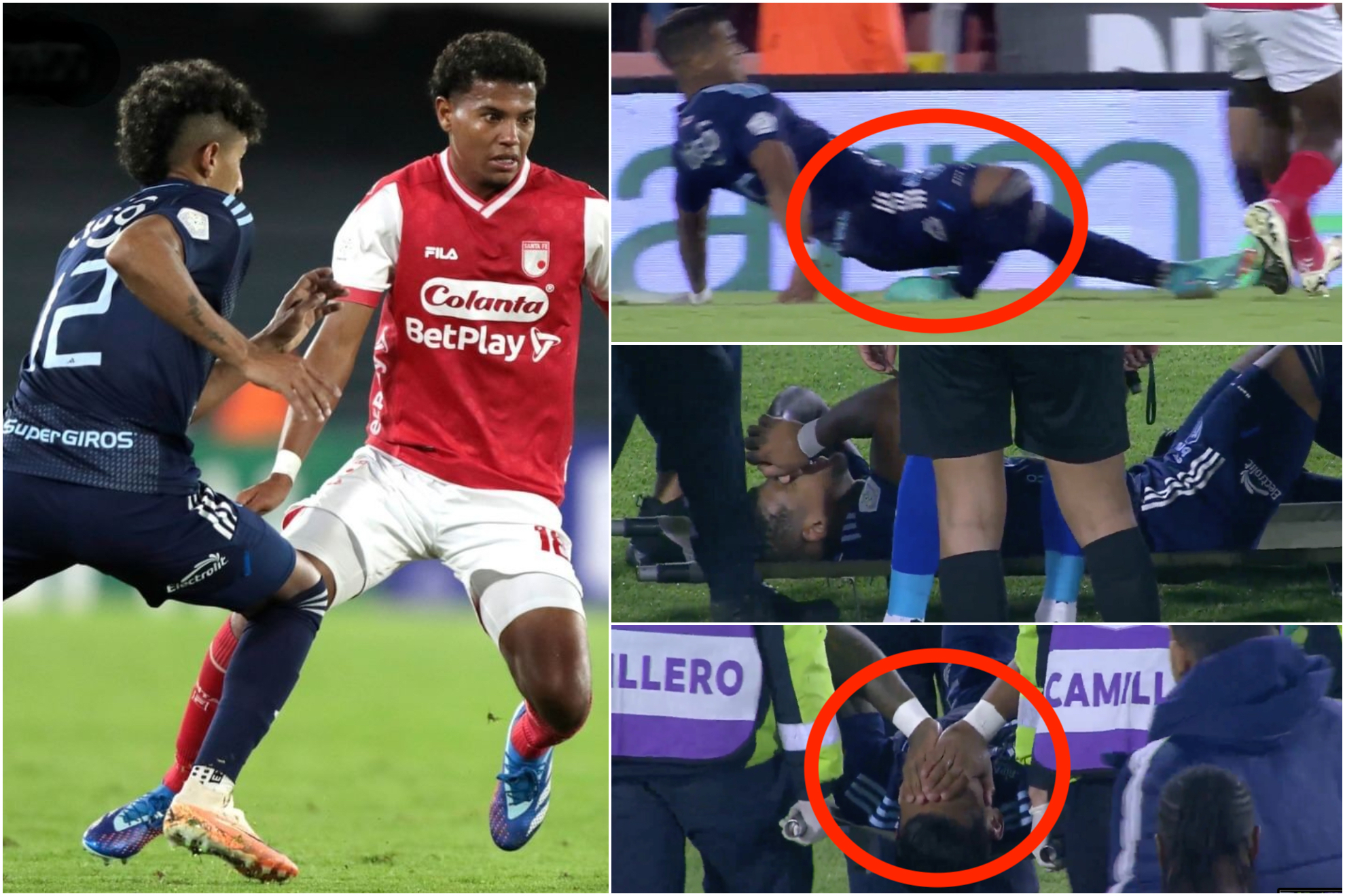 Fuerte lesión de tibia y peroné de Rafael Pérez en el partido Santa Fe vs. Junior (Instagram: Dimayor - Win Sports+)