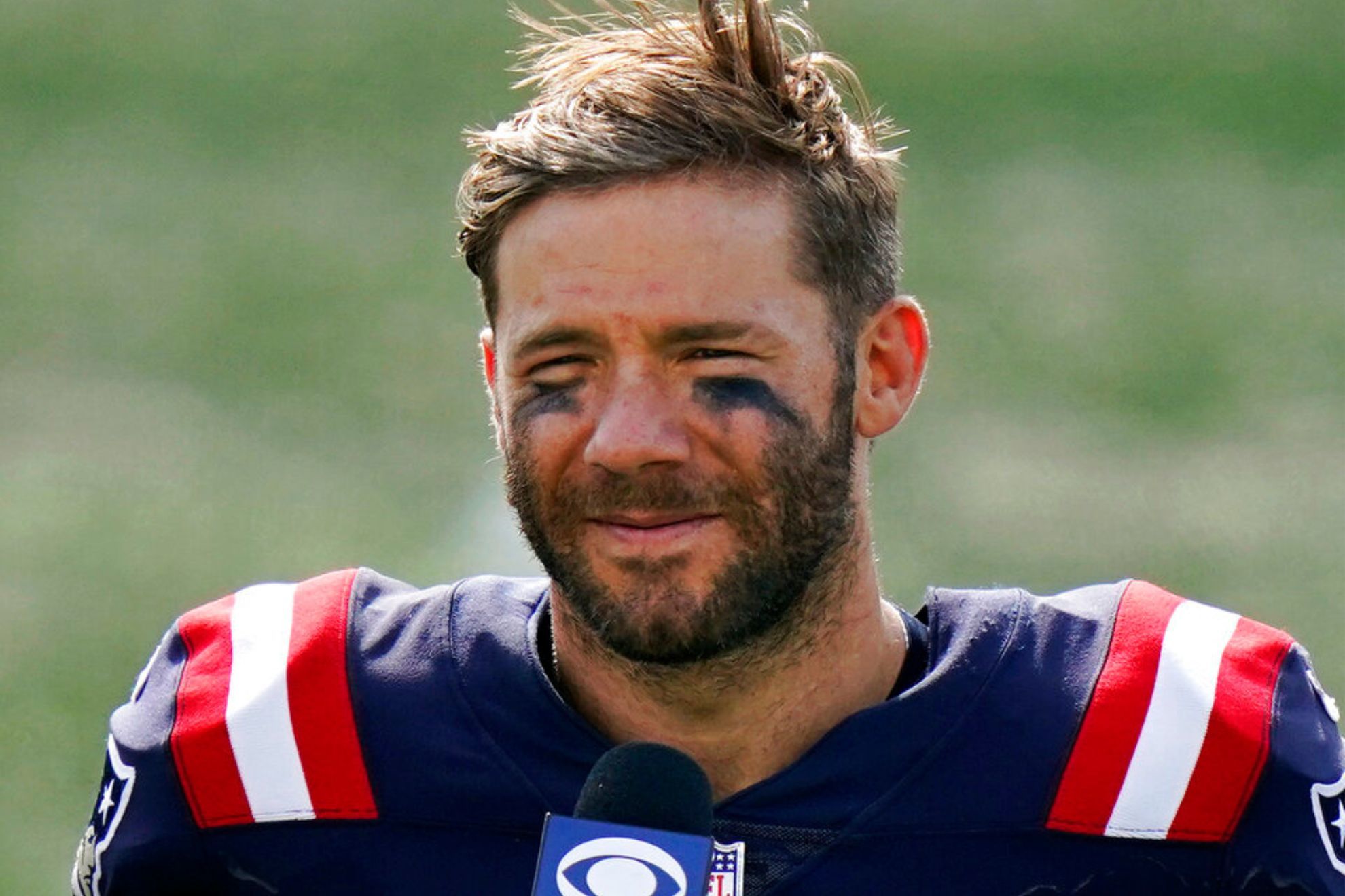 Edelman admits that Wes Welker didnt get along with Belichick