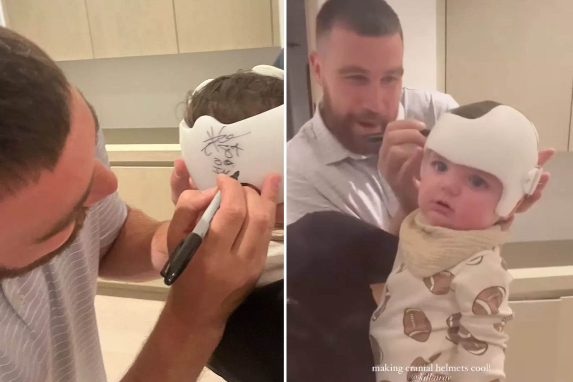 Travis Kelce makes his brother Jason proud by signing a baby boys cranial helmet