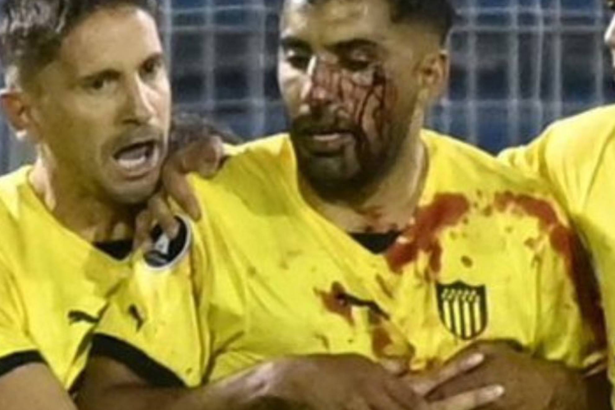 Salvaje agresin: Maxi Oliveira recibe una pedrada en la cara de la hinchada de Rosario Central