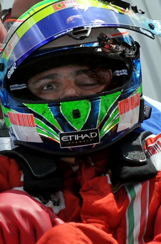 Massa, despus de su accidente en Hungra.