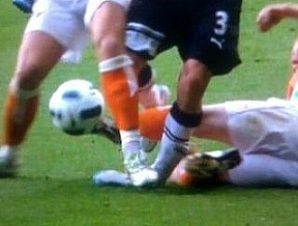 Momento en el que Adam destroza el tobillo de Bale