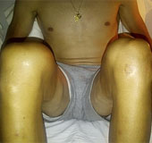 La maltrecha rodilla de Contador