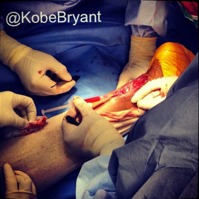 Kobe Bryant muestra al mundo cmo fue su escalofriante operacin del tendn de Aquiles