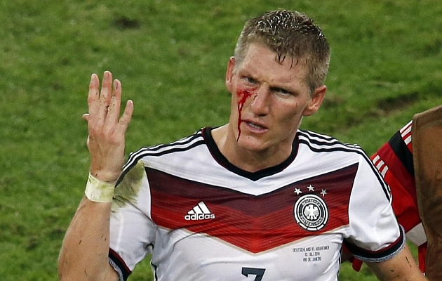 Bastian Schweinsteiger se duele de una herida en la final del Mundial de Brasil.