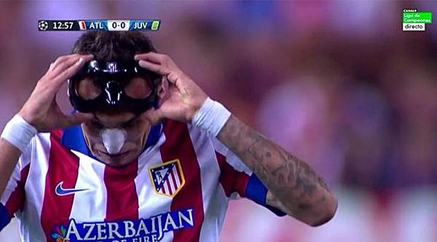 Podoactiva crea la nueva máscara protectora para Mandzukic, jugador del  Atlético de Madrid - Podoactiva. Líderes en Podología