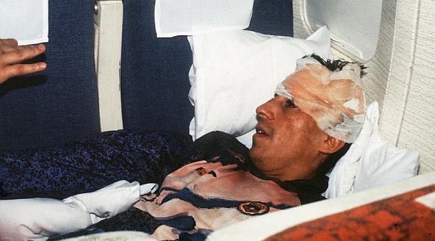 Roberto Rojas, el 3 de septiembre de 1989, despus de autolesionarse en Maracan.