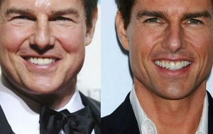 Qu se ha hecho Tom Cruise en la cara?
